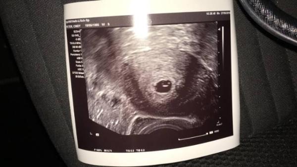 Bild zu erster FA-Termin geschafft - Forum für Januar - Mamis