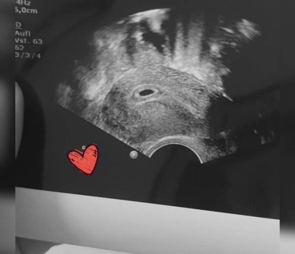 Bild zu Ich bin auch dabei :) - Forum für Januar - Mamis