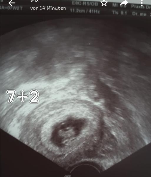 Bild zu Ramzi Theorie - Forum für Januar - Mamis