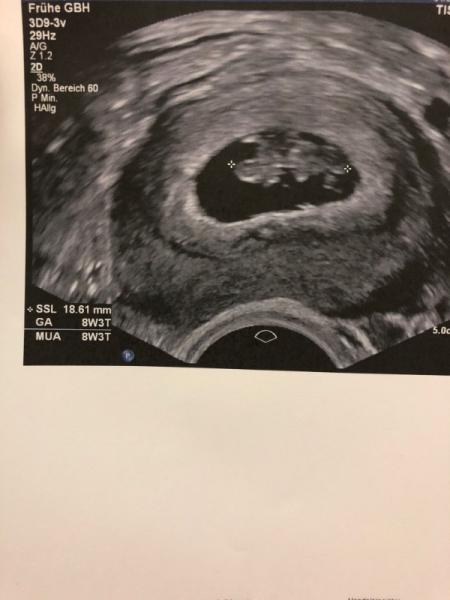 Bild zu Krankenhaus Part 2 - Forum für Januar - Mamis