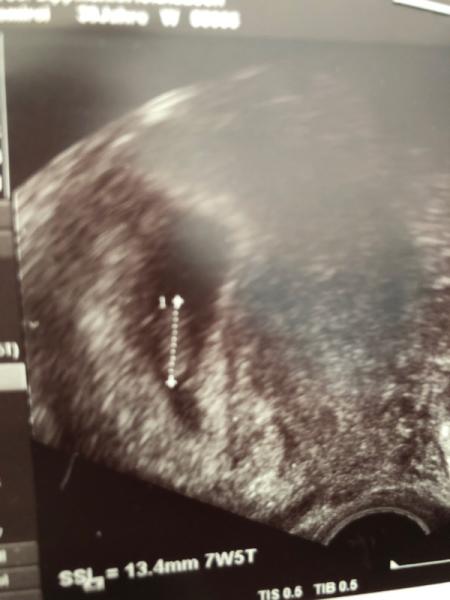 Bild zu 2. termin hinter mir... - Forum für Januar - Mamis