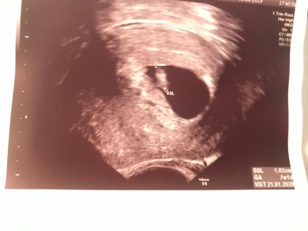 Bild zu Mutterpass und Brimborium - Forum für Januar - Mamis