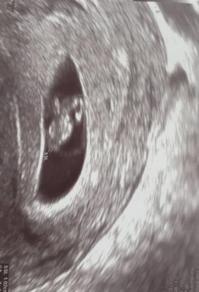 Bild zu 2 FA Termin - Forum für Januar - Mamis