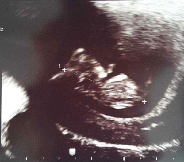 Bild zu Gute Nachrichten v. 2 US :-) - Forum für Januar - Mamis