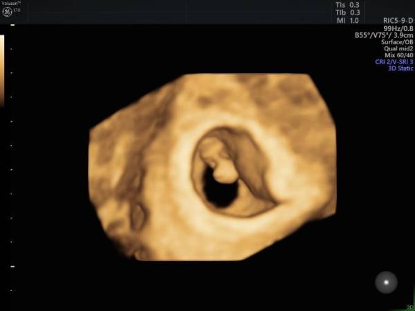 Bild zu Auch 1. FA Termin - Forum für Januar - Mamis