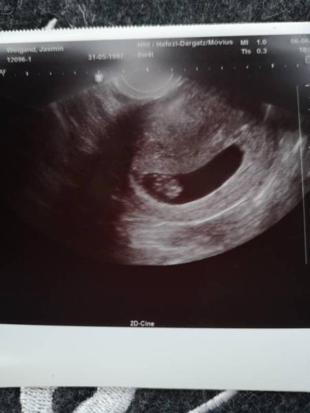 Bild zu 2. US Termin :) - Forum für Januar - Mamis