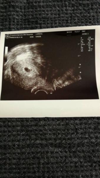 Bild zu Starke Übelkeit - Forum für Januar - Mamis