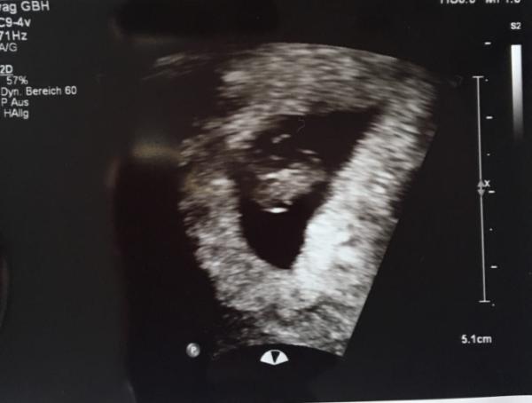 Bild zu Angst gemacht... - Forum für Januar - Mamis