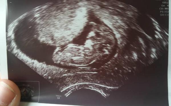 Bild zu MuKiPass und 2. US - Forum für Januar - Mamis