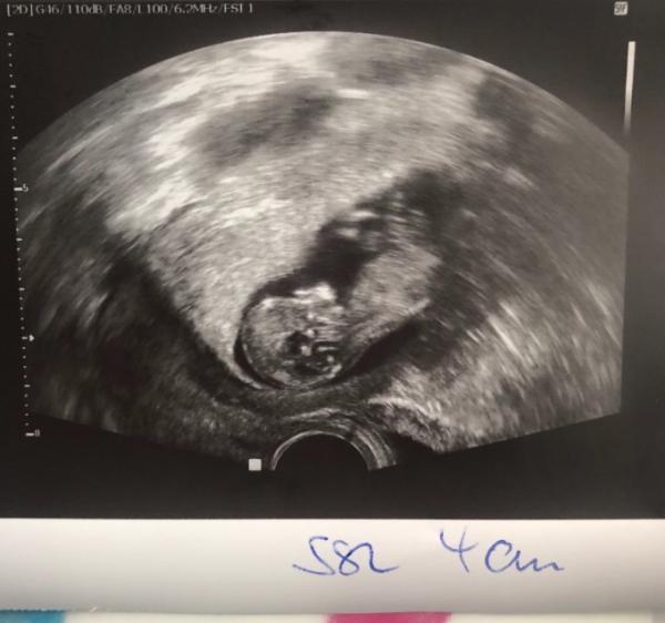 Bild zu Letztes US Bild - Forum für Januar - Mamis