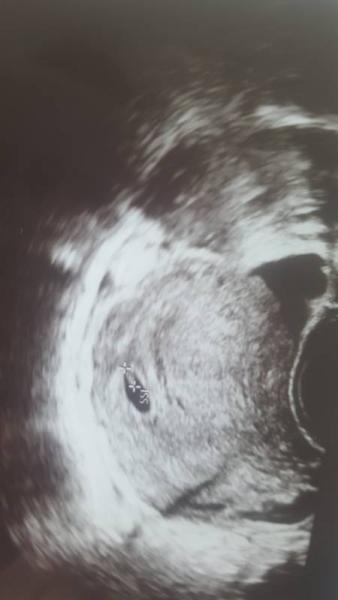 Bild zu Zurück vom Frauenarzt :-) 😍 - Forum für Januar - Mamis