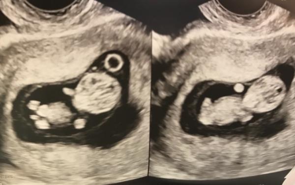 Bild zu Ein kleines Alien - Forum für Januar - Mamis