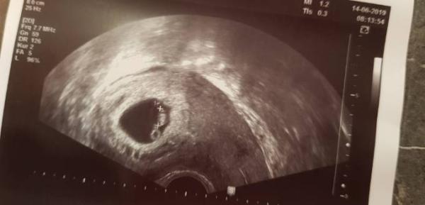 Bild zu Zurück vom FA - Forum für Januar - Mamis