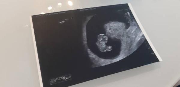 Bild zu Frauenarzt Update :) - Forum für Januar - Mamis