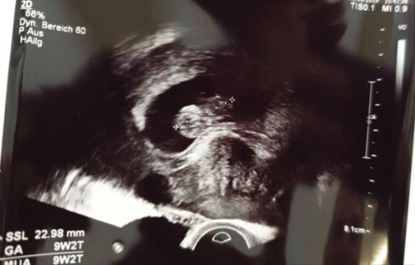 Bild zu Gestern FA 2. Ultraschall 9+2 - Forum für Januar - Mamis