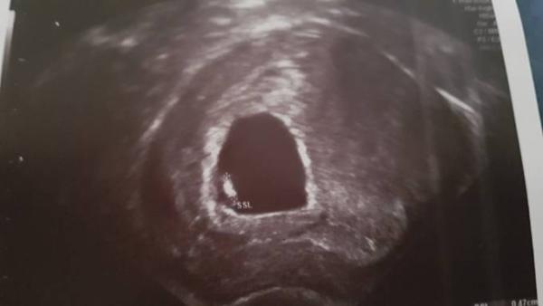 Bild zu vorsichtig anklopf - Forum für Januar - Mamis