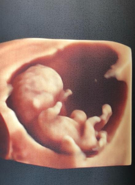 Bild zu 1. Trimester Screening - Forum für Januar - Mamis