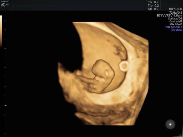 Bild zu wieder ein kleines 3D Bildchen:) - Forum für Januar - Mamis