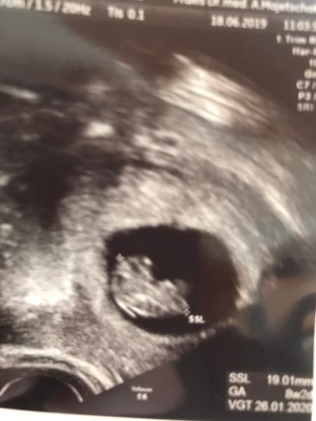 Bild zu Ich Grüße euch alle 🙋‍♀️ - Forum für Januar - Mamis