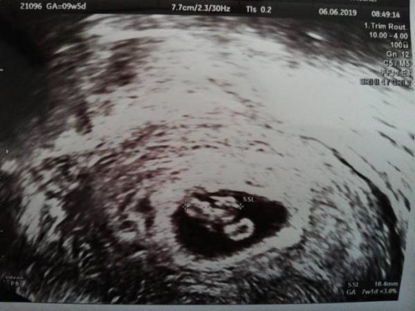 Bild zu Viele viele Fragen und Sorgen - Forum für Januar - Mamis