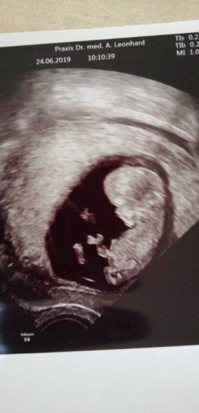 Bild zu Neu in der Runde - Forum für Januar - Mamis