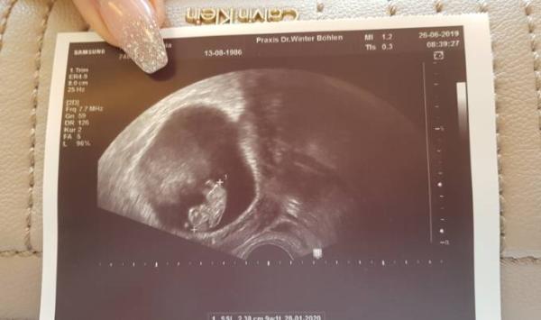 Bild zu zurück vom FA - Forum für Januar - Mamis