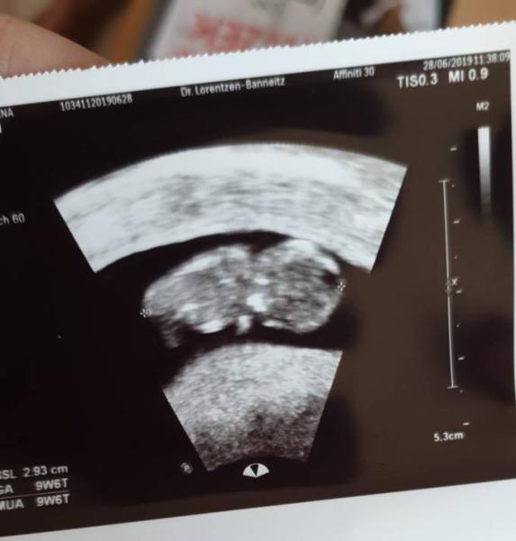 Bild zu 10.woche - Forum für Januar - Mamis