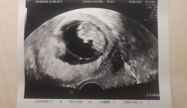 Bild zu Ausflug ins Krankenhaus - Forum für Januar - Mamis