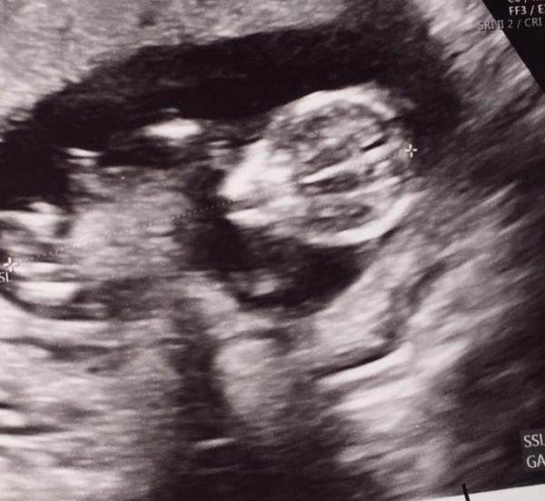 Bild zu Arzttermin - Forum für Januar - Mamis