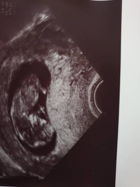 Bild zu Beschäftigungsverbot... - Forum für Januar - Mamis