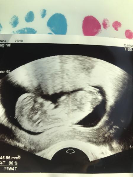 Bild zu Zweiter Ultraschall gestern - Forum für Januar - Mamis