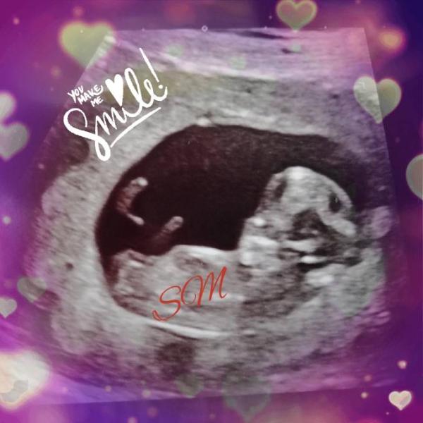 Bild zu Endlich 12 Ssw... trotzdem weiterhin Sorgen - Forum für Januar - Mamis