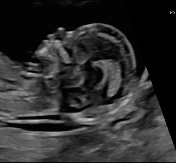 Bild zu Geht es euch ähnlich? - Forum für Januar - Mamis