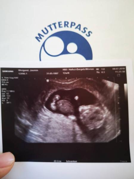 Bild zu Fa Termin :) - Forum für Januar - Mamis