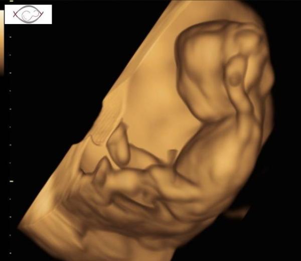 Bild zu Auch wir durften heute endlich Babygucken 😍 - Forum für Januar - Mamis