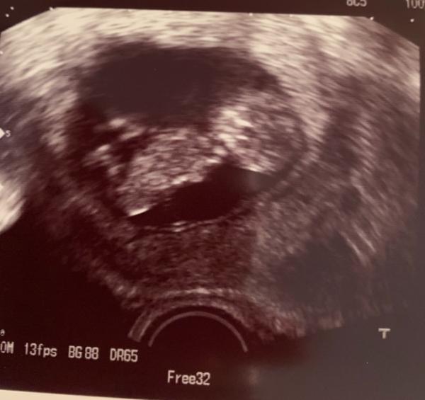 Bild zu Heute endlich wieder beim Arzt gewesen... - Forum für Januar - Mamis