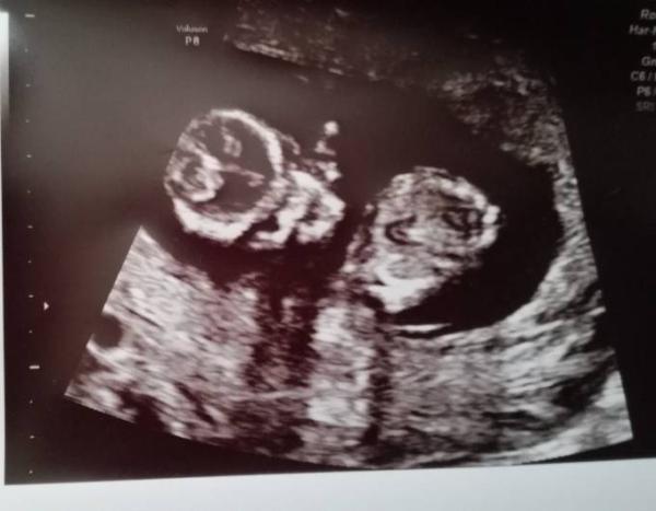 Bild zu freu - Forum für Januar - Mamis