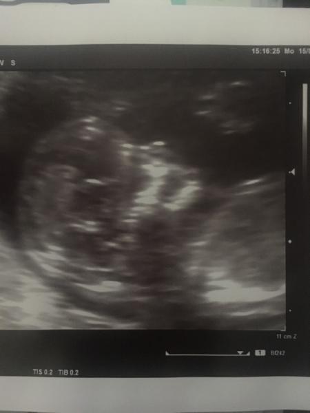 Bild zu Das Krümelchen wieder gesehen - Forum für Januar - Mamis