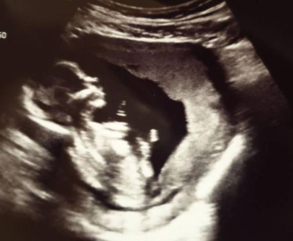 Bild zu Gestern endlich wieder FA Termin gehabt :) - Forum für Januar - Mamis