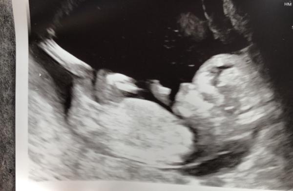 Bild zu Hallo zusammen ☺️ - Forum für Januar - Mamis