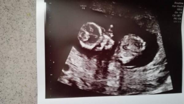 Bild zu Outing? - Forum für Januar - Mamis