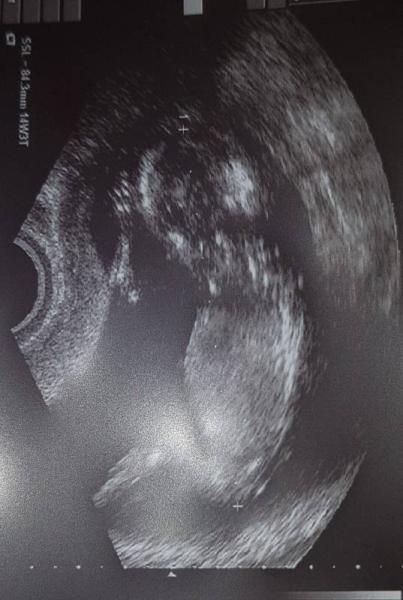 Bild zu Außerplanmäßiger FA-Besuch - Forum für Januar - Mamis