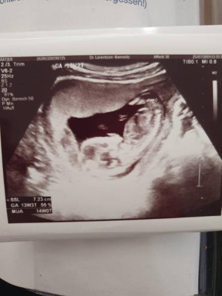 Bild zu 14.Woche - Forum für Januar - Mamis