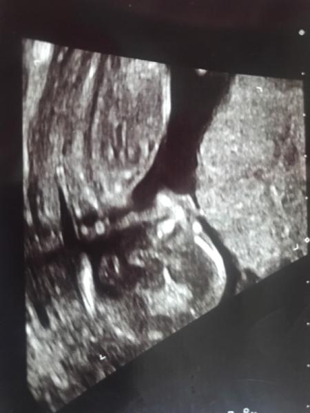 Bild zu Outing - Forum für Januar - Mamis