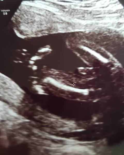 Bild zu Outiing🥰 - Forum für Januar - Mamis