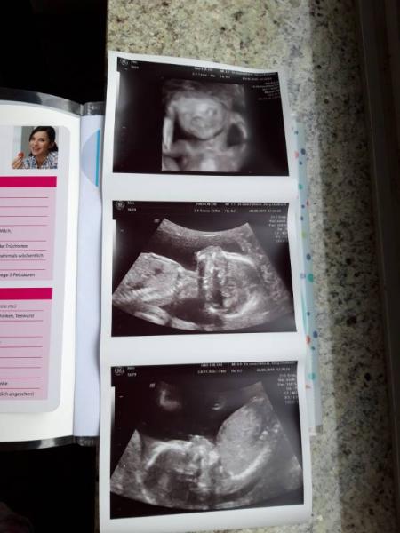 Bild zu Zurück vom Ultraschall - Forum für Januar - Mamis