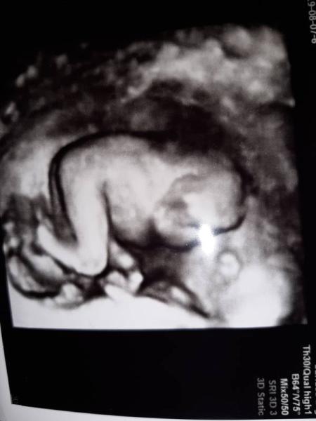 Bild zu ÜBERGLÜCKLICH - Forum für Januar - Mamis