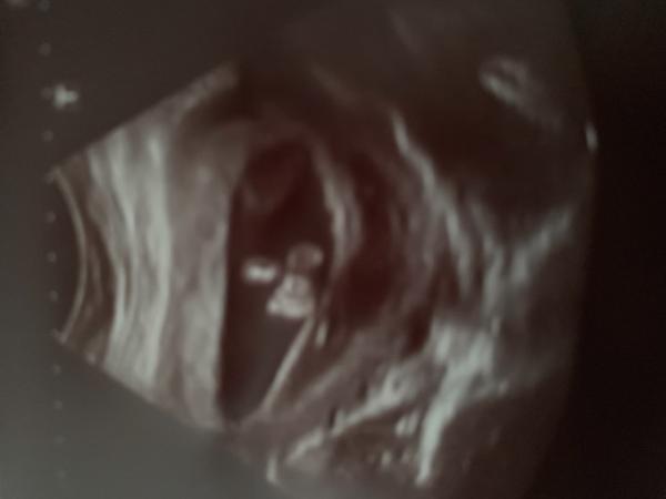 Bild zu Was es nicht alles gibt. ... - Forum für Januar - Mamis