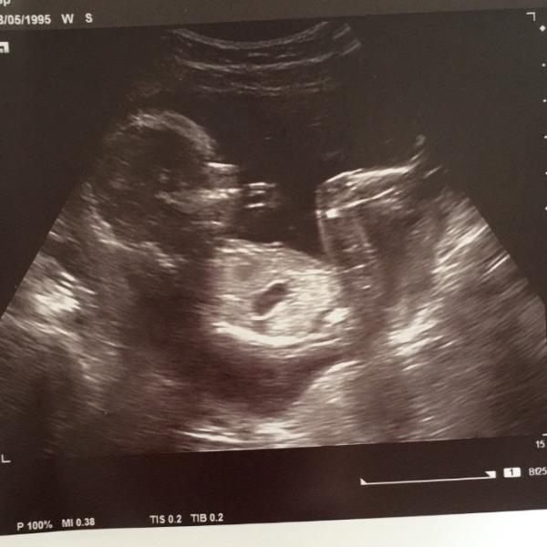 Bild zu Vorsichtiges Outing - Forum für Januar - Mamis