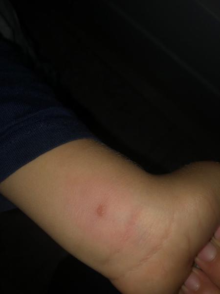 Bild zu Was kann das sein? - Forum für Januar - Mamis